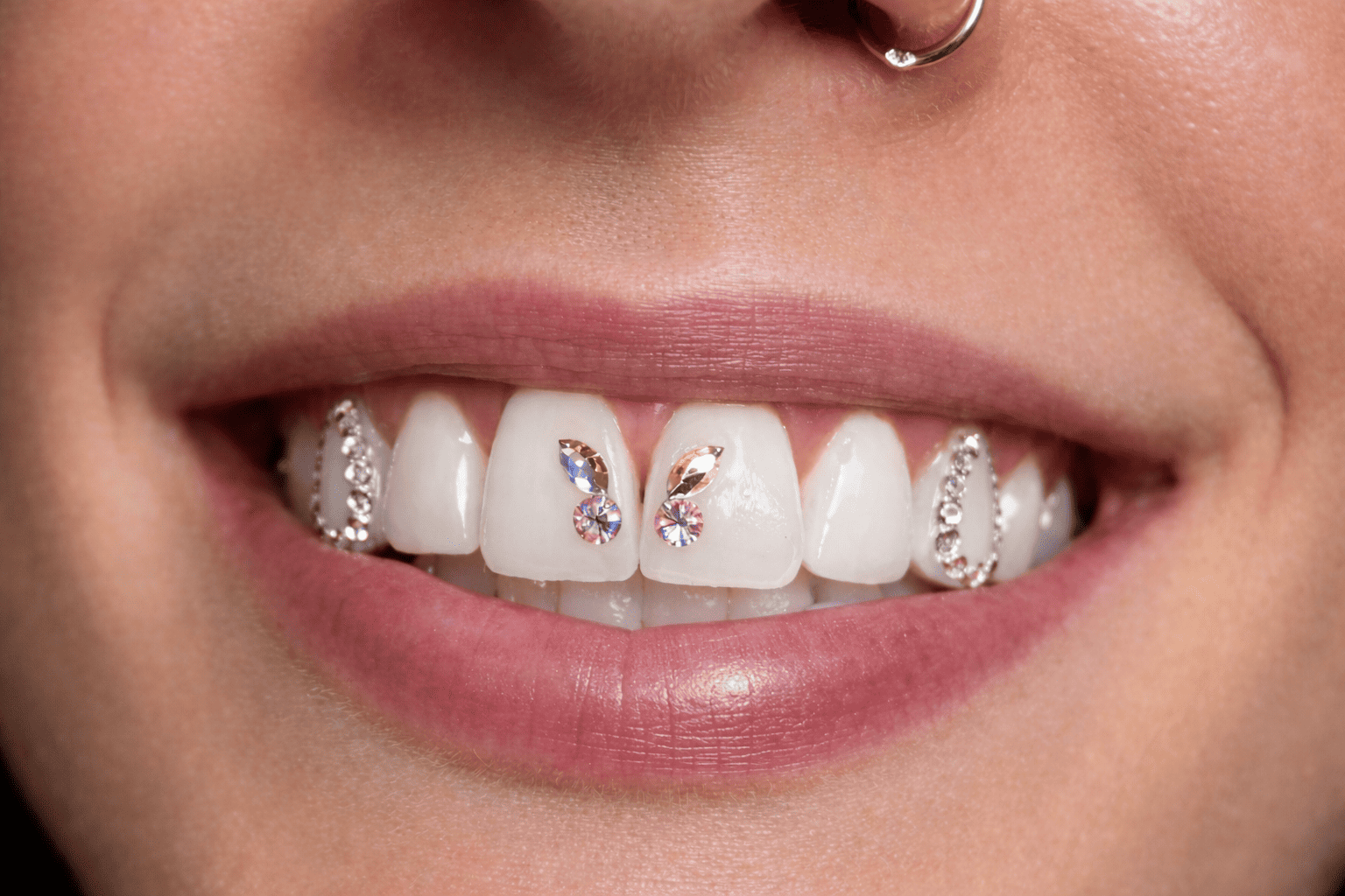 Formation Strass Dentaire – Pose de bijoux